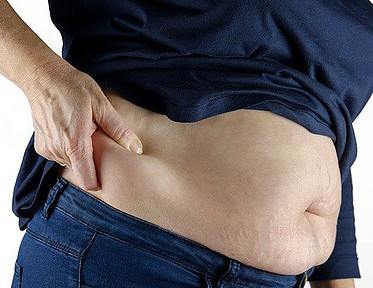 Image photo: Saggy belly of an individual